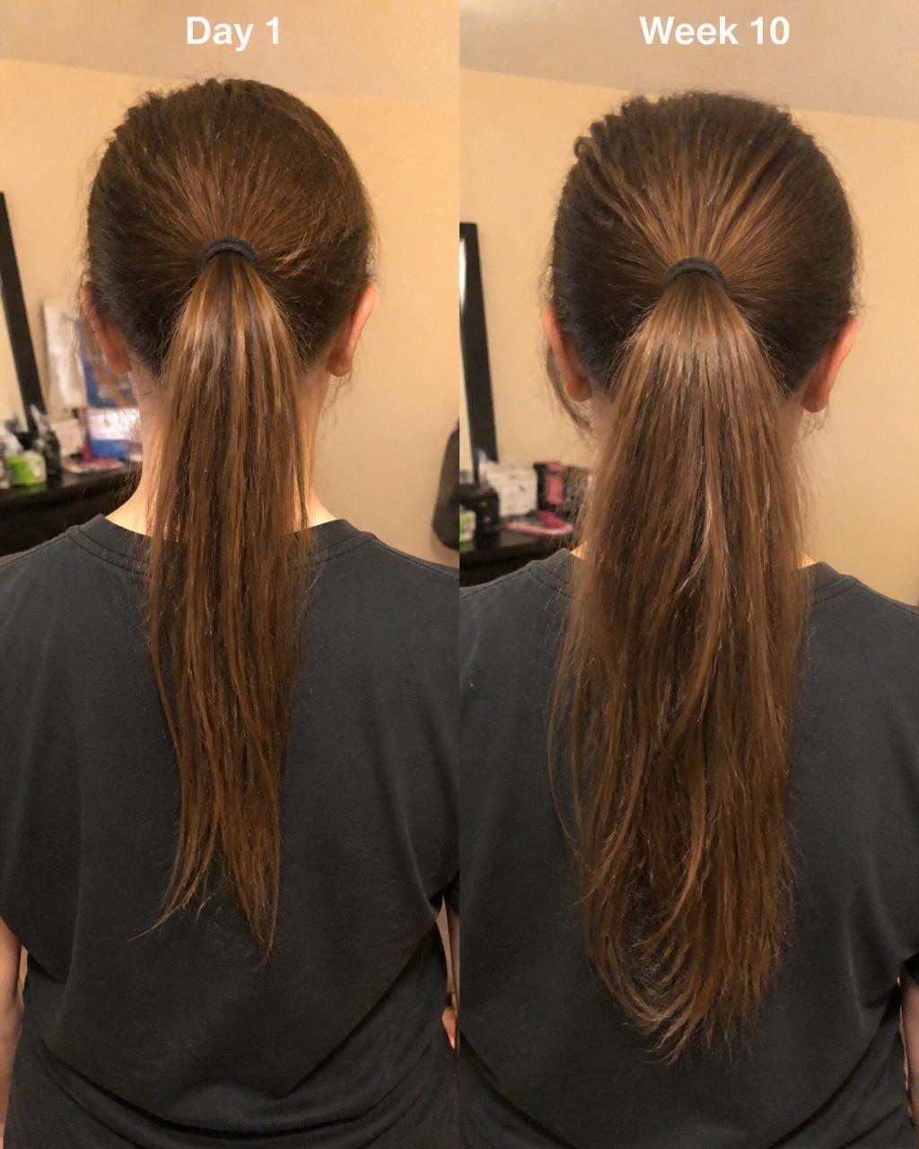Lily's hair transformation — before and after 10 weeks of Maple Botanics