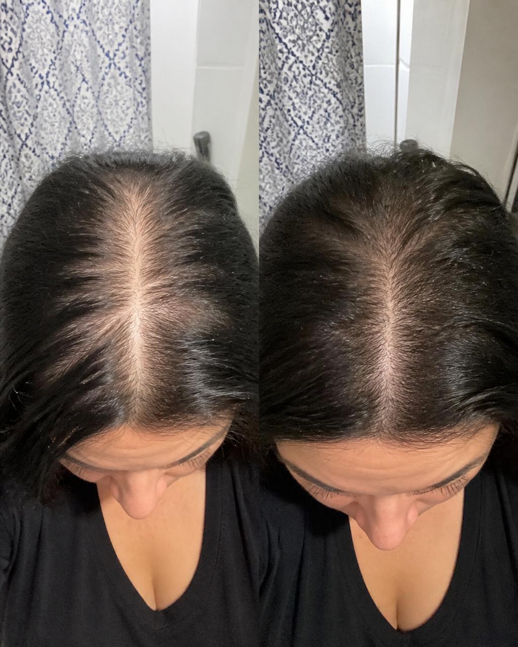 Zara's hair transformation — before and after 16 weeks of Maple Botanics