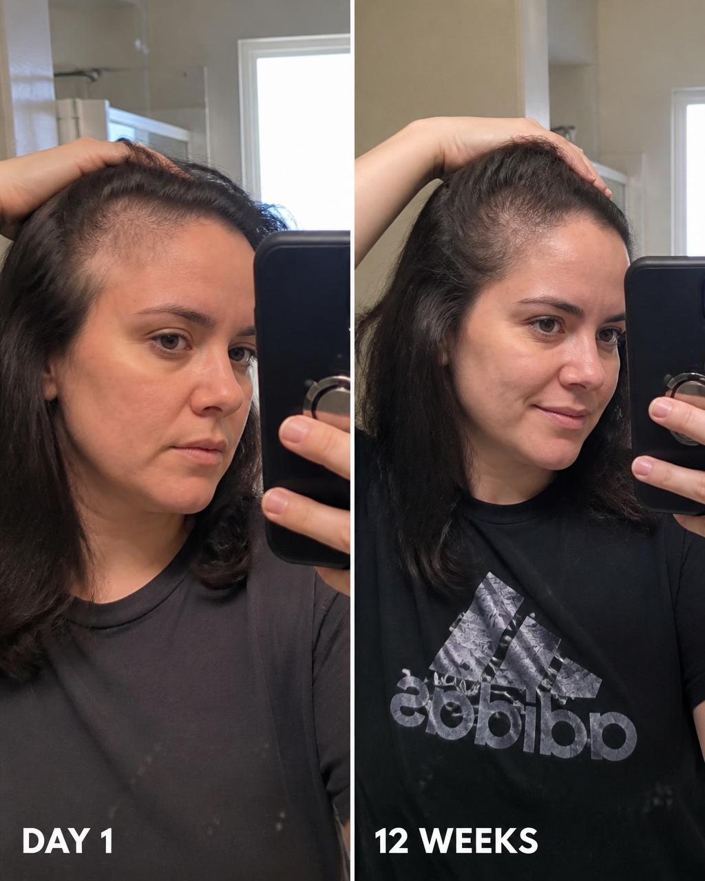 Amelia's hair transformation — before and after 12 weeks of Maple Botanics